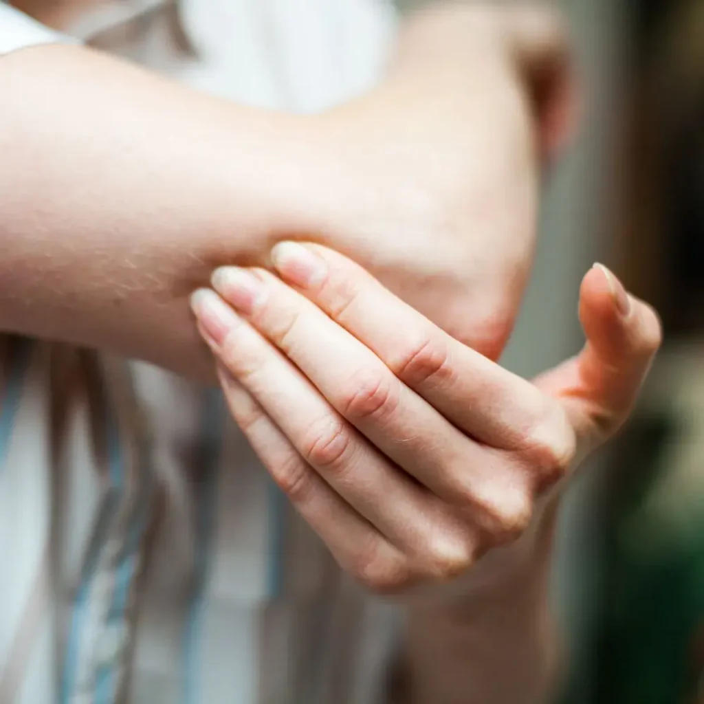 A person holds their left elbow with their right hand, appearing to examine or soothe the area. The background is blurred, focusing on the hands and elbow.