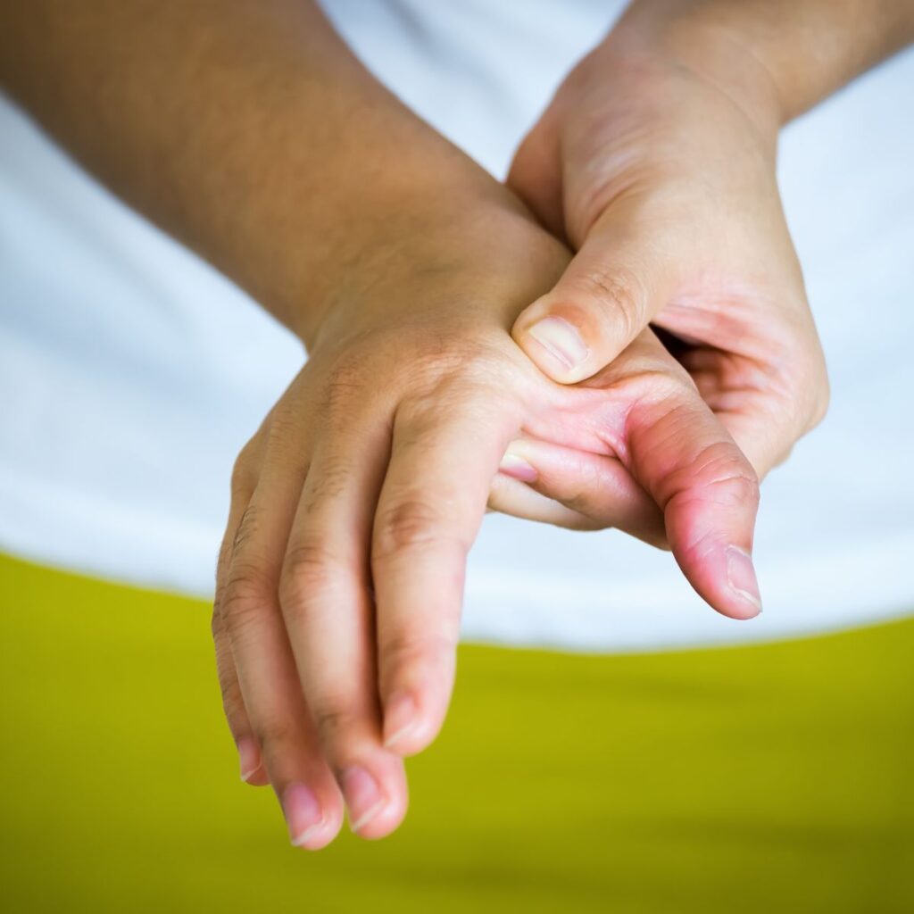 A person holding their swollen, red thumb with their other hand, possibly indicating pain or injury. The background is out of focus and yellow.
