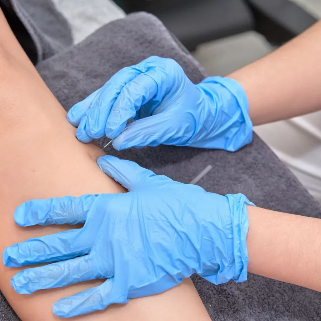 A person wearing blue latex gloves inserts a thin needle into another persons arm, possibly for a medical procedure or blood draw, while both rest on a gray towel.